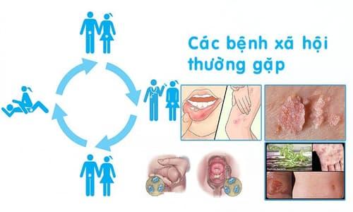 cac-loai-benh-xa-hoi.jpg