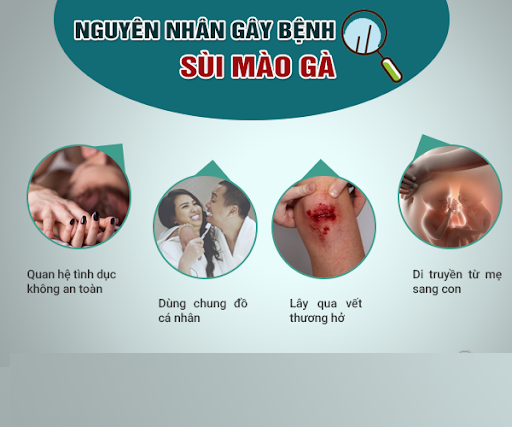 nguyen nhan gay sui mao ga 1.png